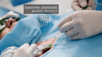 laserowe usuwanie guzkow tarczycy bydgoszcz bienkowscy wp