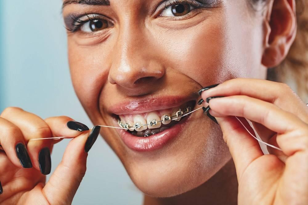 Invisalign vs tradycyjne aparaty – co jest skuteczniejsze?