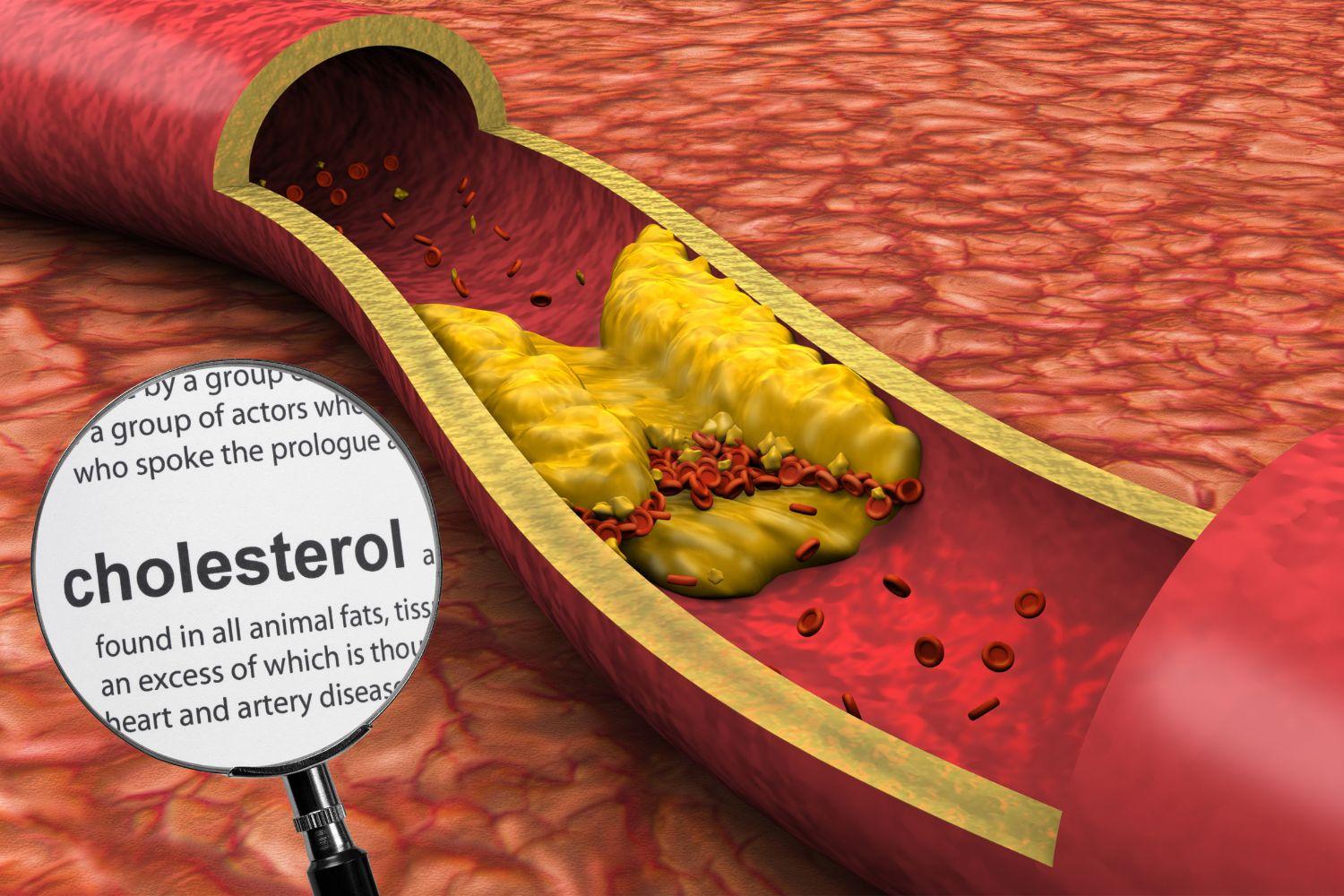 cholesterol
