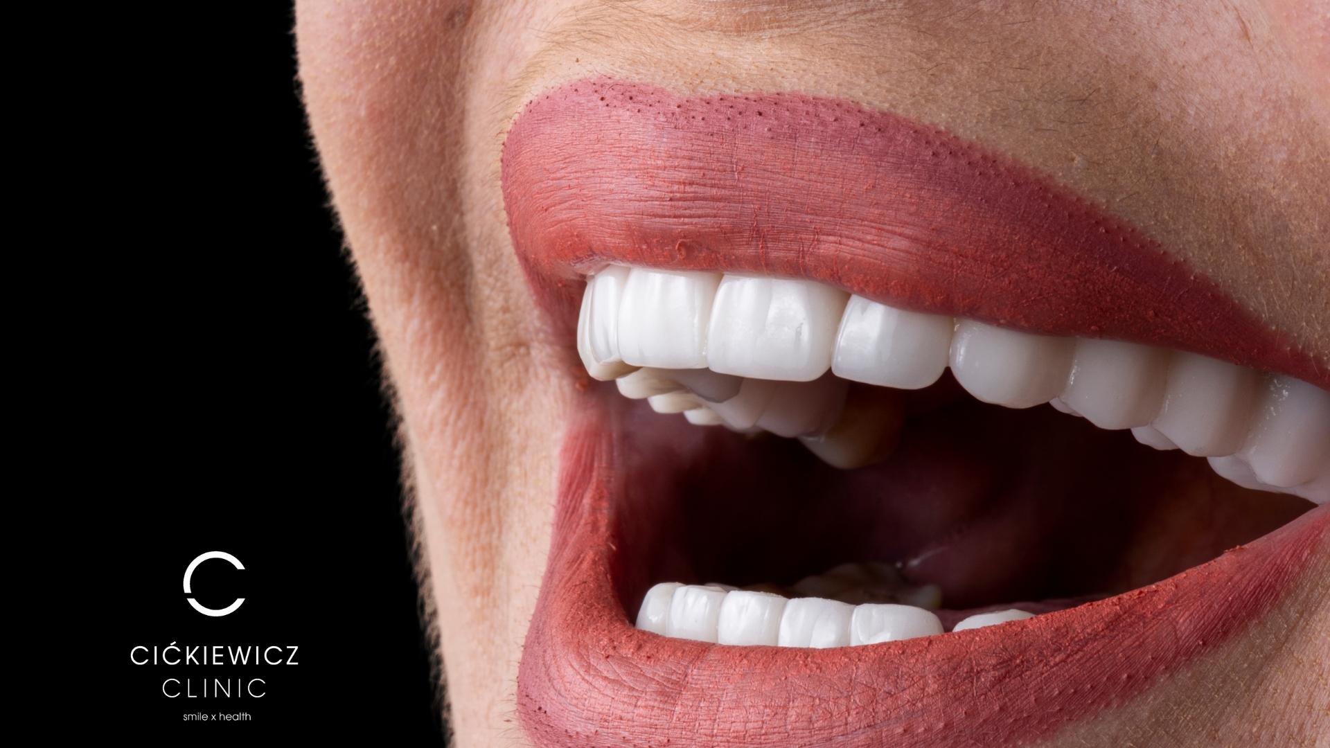 Licówki czy wybielanie? Co sprawdzi się w Twoim przypadku?