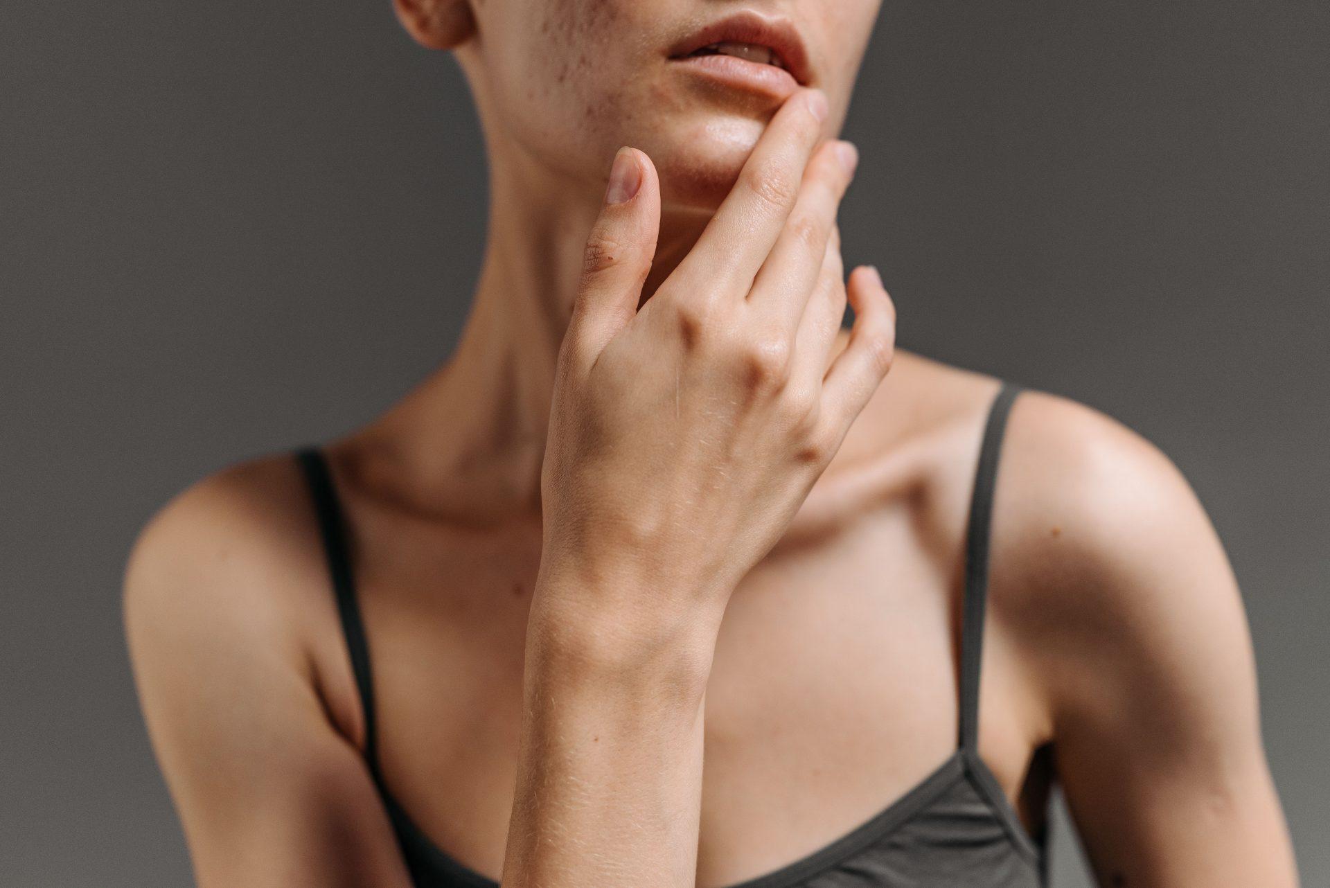 Wysyp niedoskonałości i przebarwień po lecie. Kiedy domowe sposoby zawodzą i niezbędna staje się specjalistyczna dermatologia?